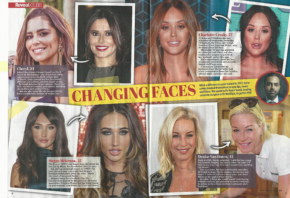Dr Somji comments on how celeb  faces have changed in Reveal