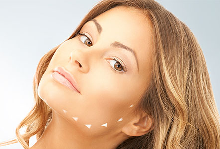 jawline contouring with fillers
