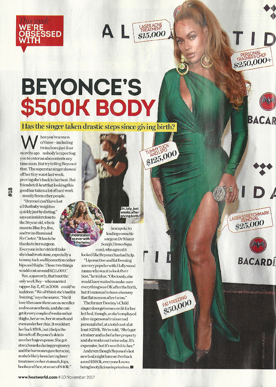 Dr Somji comments on Beyonce's $500K body