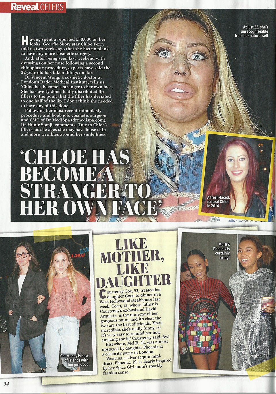 Dr Somji comments on Chloe's face in REVEAL Celebs