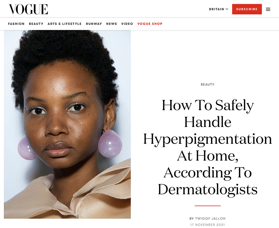 hyperpigmentation tips