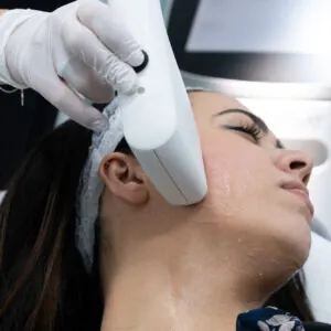 30% off Sofwave single session